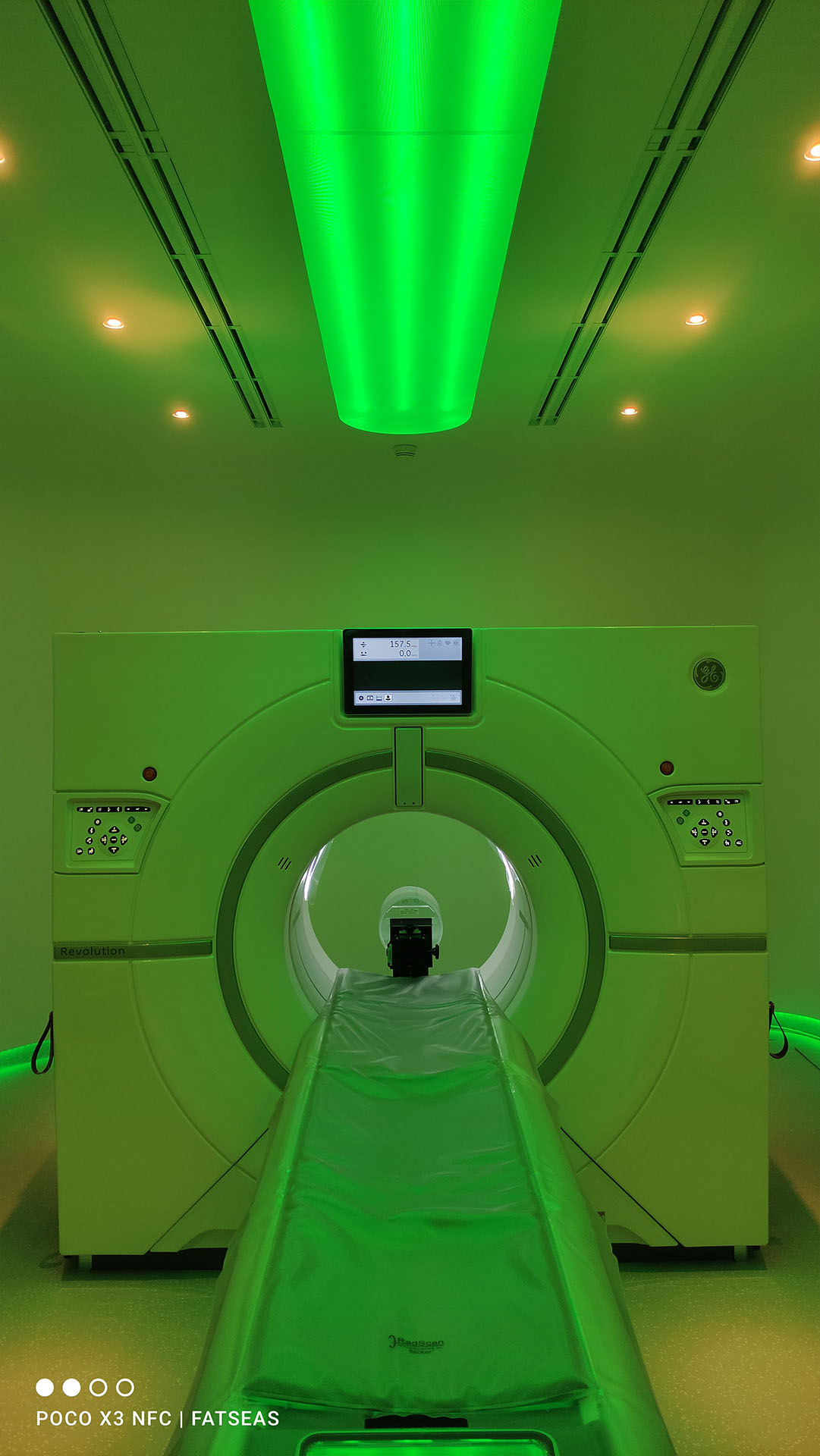 CT Scan Revolution